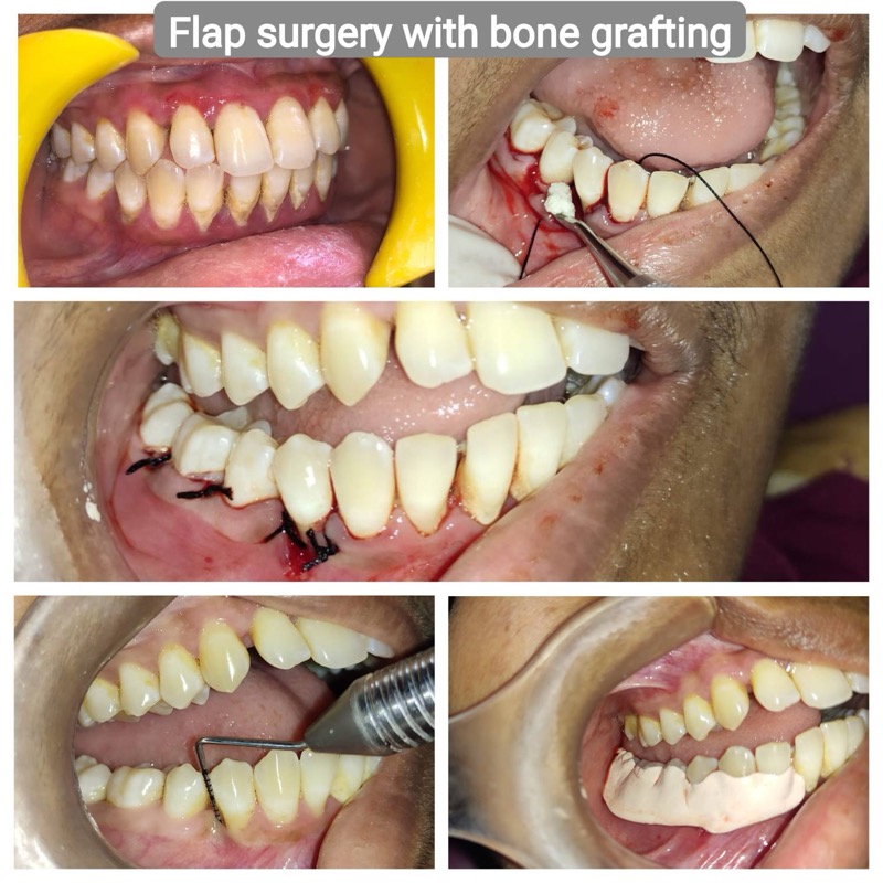 Patient case - before and after