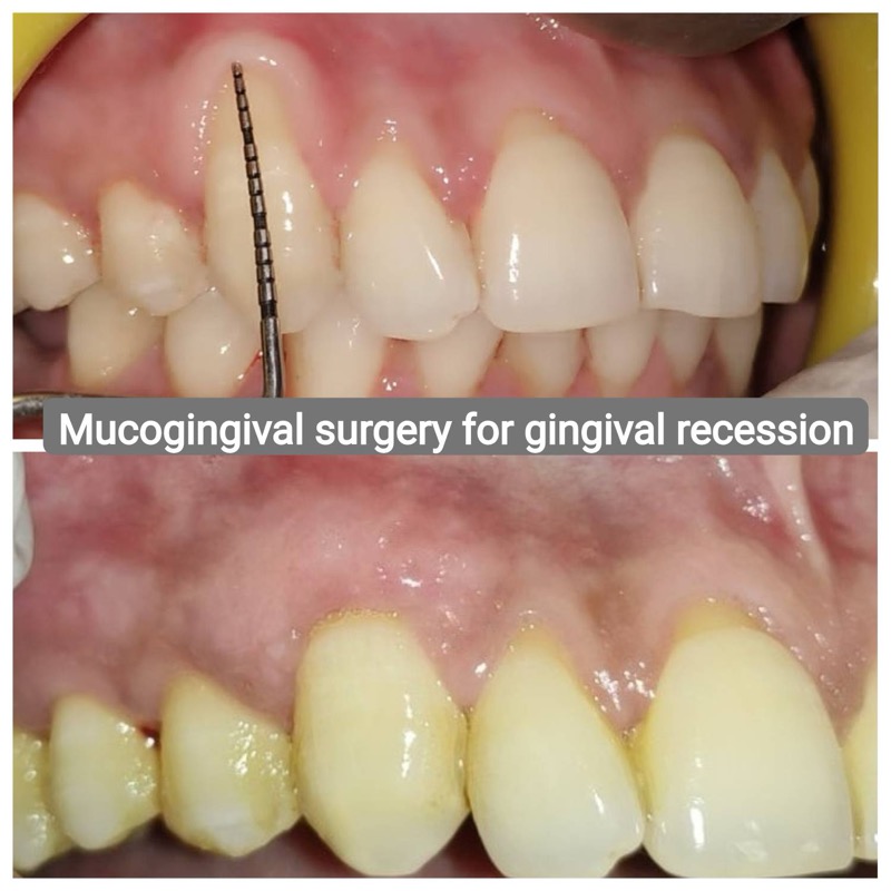 Patient case - before and after